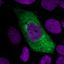 Lung cell infected with SARS-CoV-2 forms new virus particles (green) in its cytoplasm (violet: cell nuclei). ©HZI/Ulfert Rand